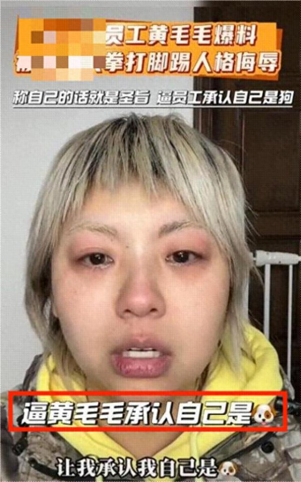 把助理当奴才使唤的恶毒女星, 终于遭报应了! 全网: 活该
